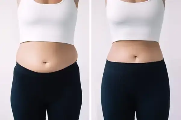 Before & After