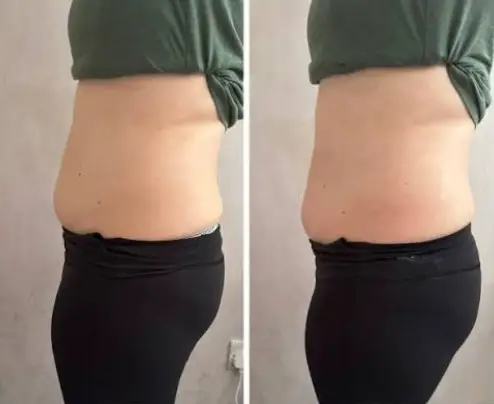 Before & After