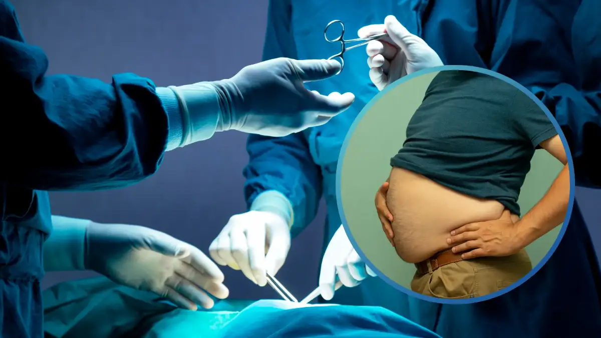 Obesity Surgery